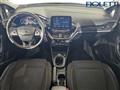 FORD FIESTA 1.1 75 CV 5 porte Titanium