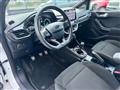 FORD FIESTA 1.0 Ecoboost Hybrid 125 CV 5 porte ST-Line