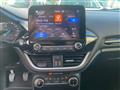 FORD FIESTA 1.1 BENZ/GPL 75CV 5 porte Titanium con Retrocamera