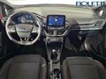 FORD FIESTA 1.0 Ecoboost 95 CV 5 porte ST-Line